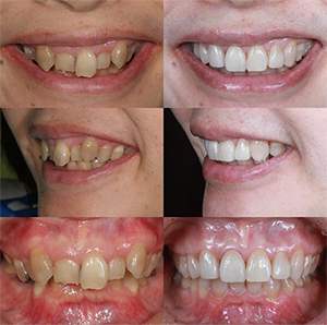 03のサムネイル