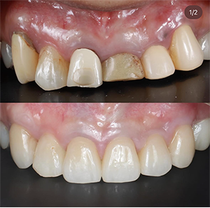 04のサムネイル