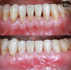 05のサムネイル