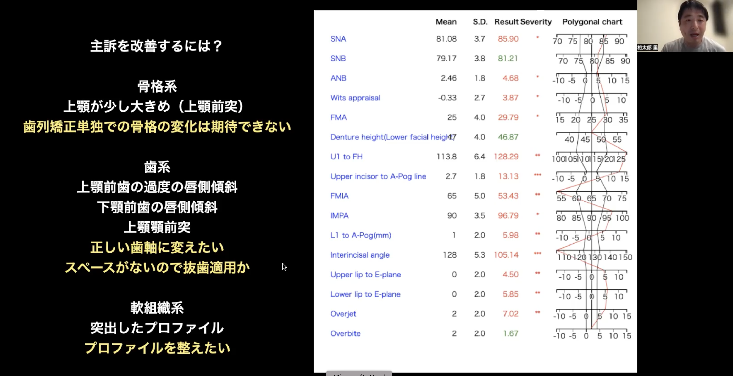 2024年2月17日「矯正の学校」のご紹介